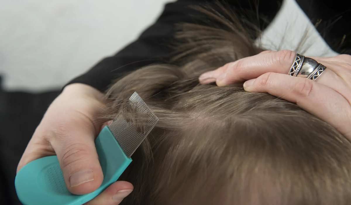استفاده از شانه ریز برای درمان شپش موی سر