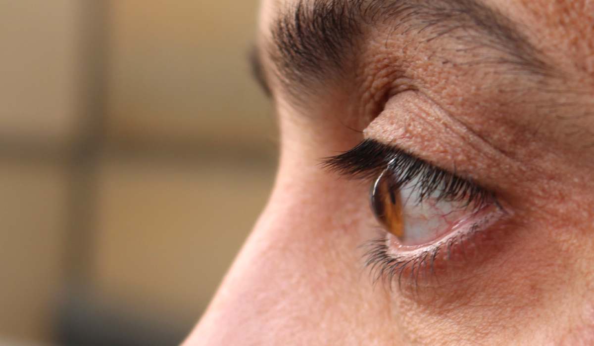 قوز قرنیه در چشم یکی از انواع بیماری های چشمی است