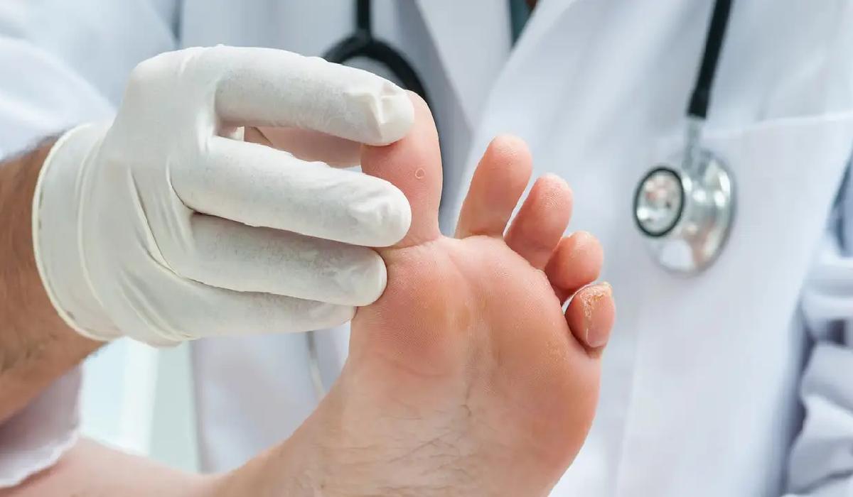 مراجعه به پزشک و بهداشت پا برای درمان زخم پای دیابتی