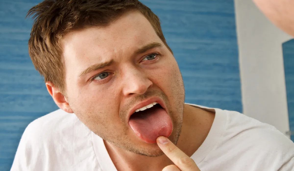 خشکی دهان ممکن است نشانه وجود برخی بیماری ها باشد
