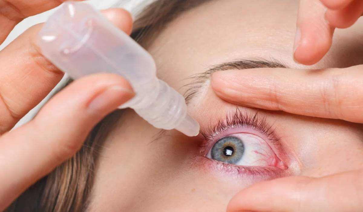 درمان عفونت چشم با قطره