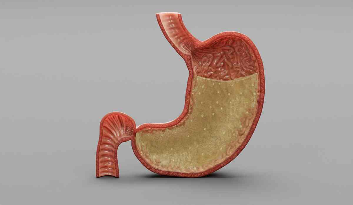 اسید معده چیست؟ معرفی 7 نوع از بیماری های اسید معده