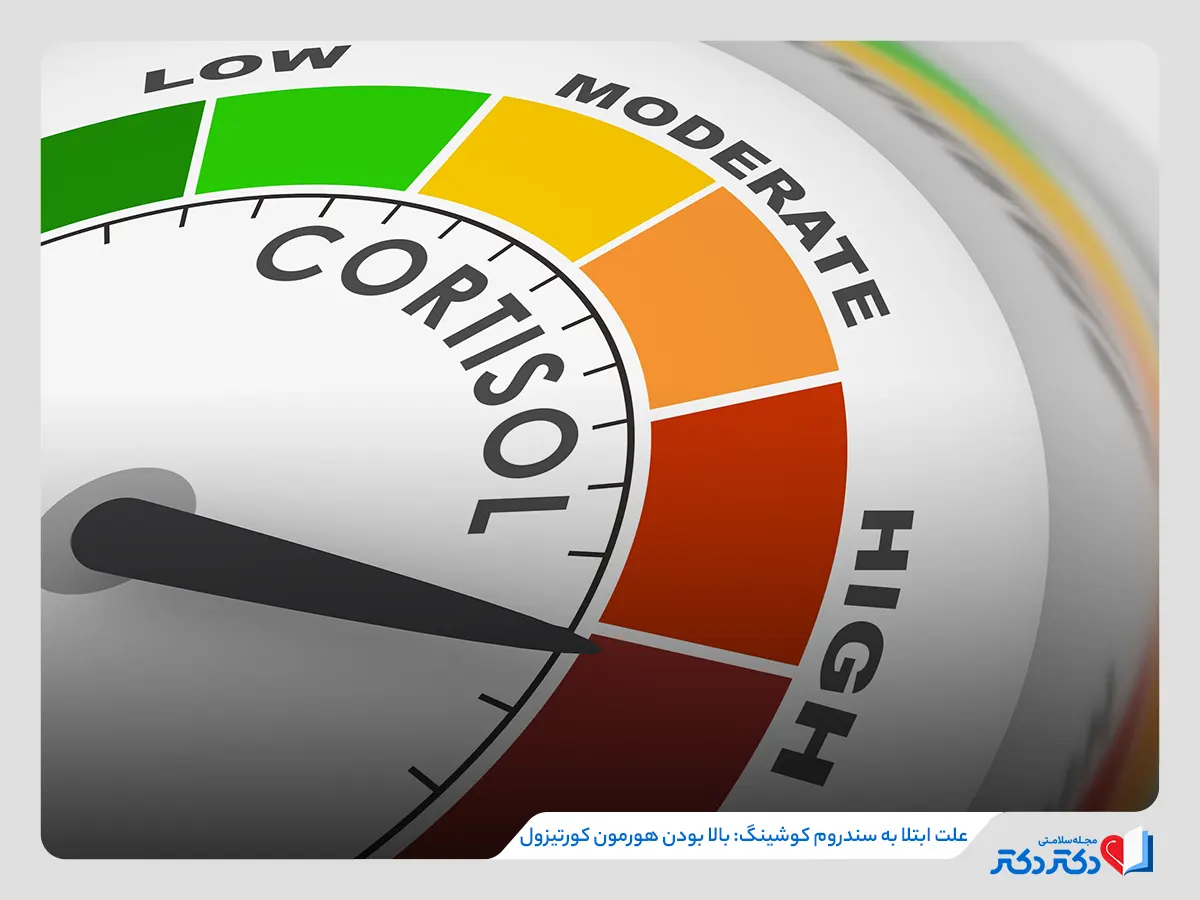 بالا بودن هورمون کورتیزول علت‌ بروز سندروم کوشینگ