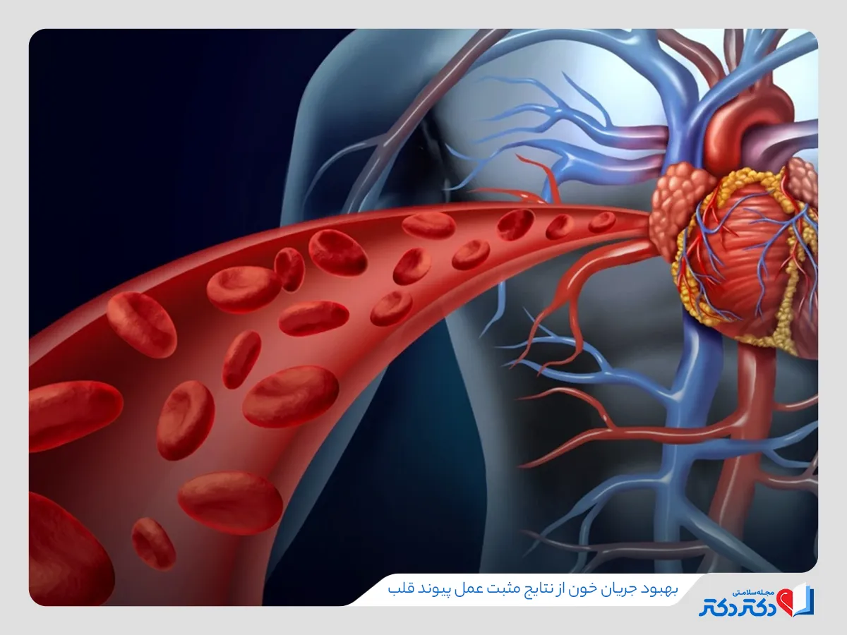  بهبود جریان خون بعد از عمل پیوند قلب
