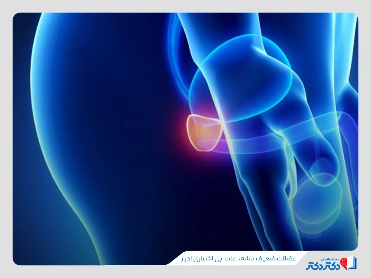 ضعیف بودن عضلات مثانه، علت بی اختیاری ادرار