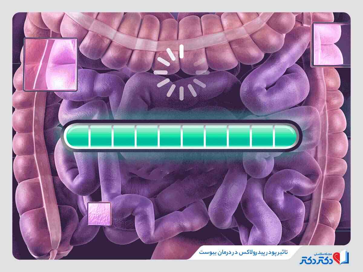 کاربردهای درمانی و تاثیر پودر پیدرولاکس برای درمان یبوست 