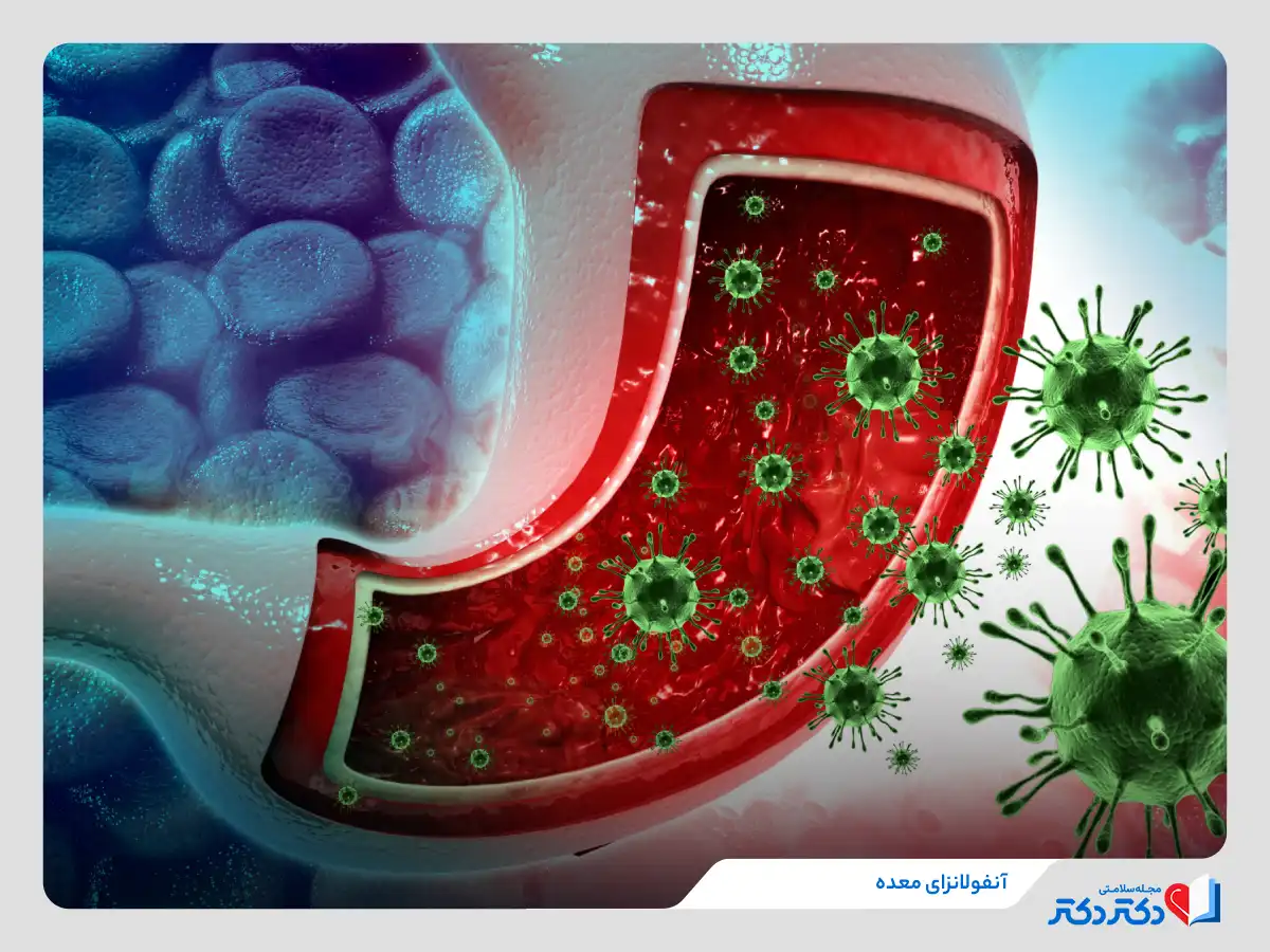 گاستروانتریت یا آنفولانزای معده 