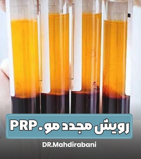 alt پی آر پی