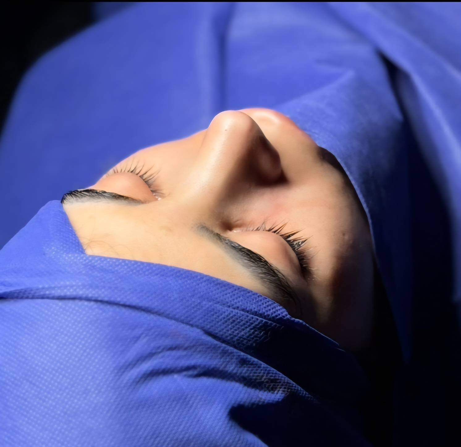 alt جراحی زیبایی بینی