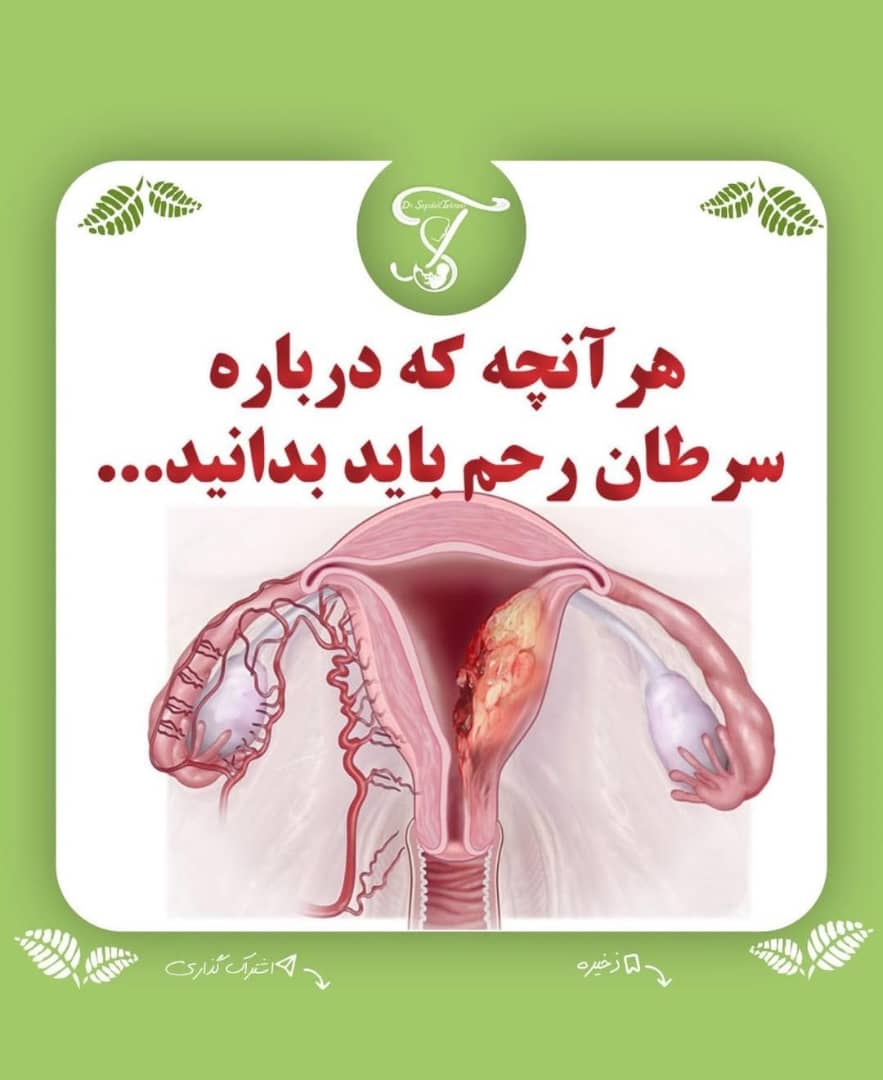 alt هر آنچه که درباره سرطان رحم باید بدانید