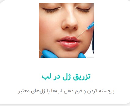 alt تزریق ژل در لب