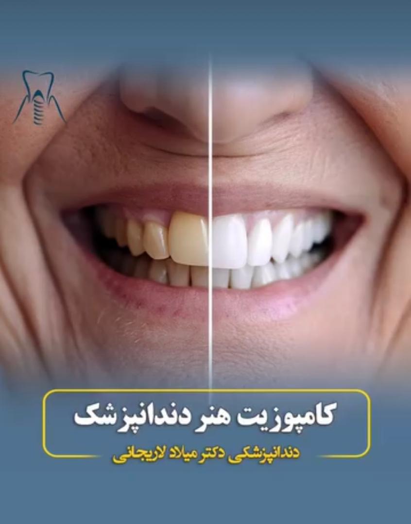 alt کامپوزیت