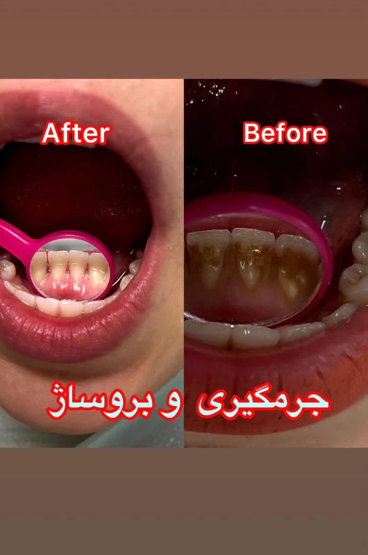 alt جرم گیری
