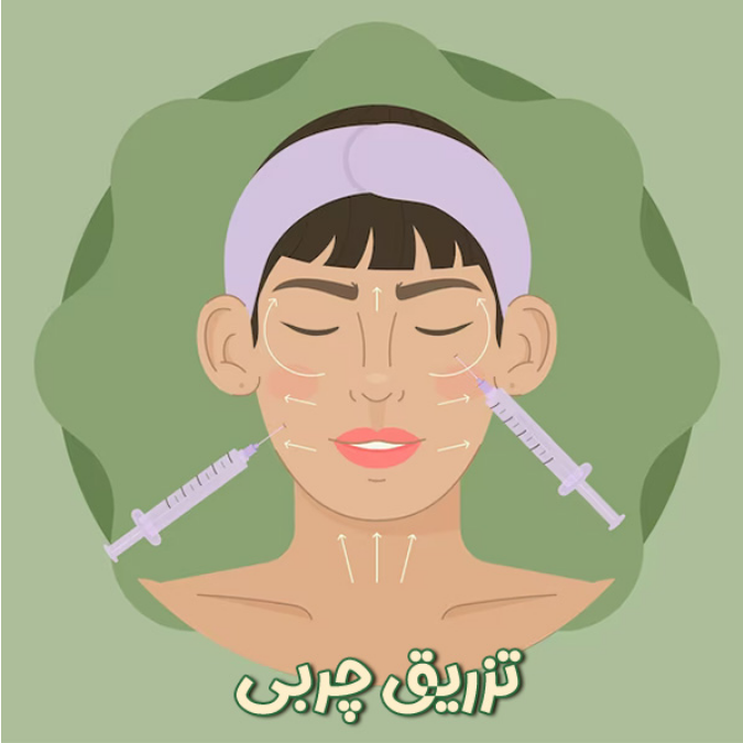 alt تزریق چربی