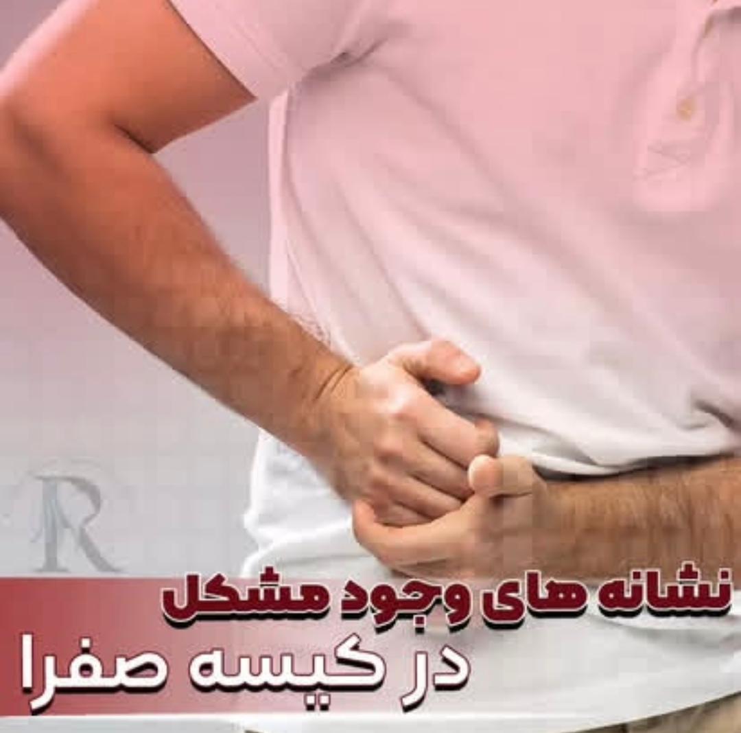 alt کیسه صفرا