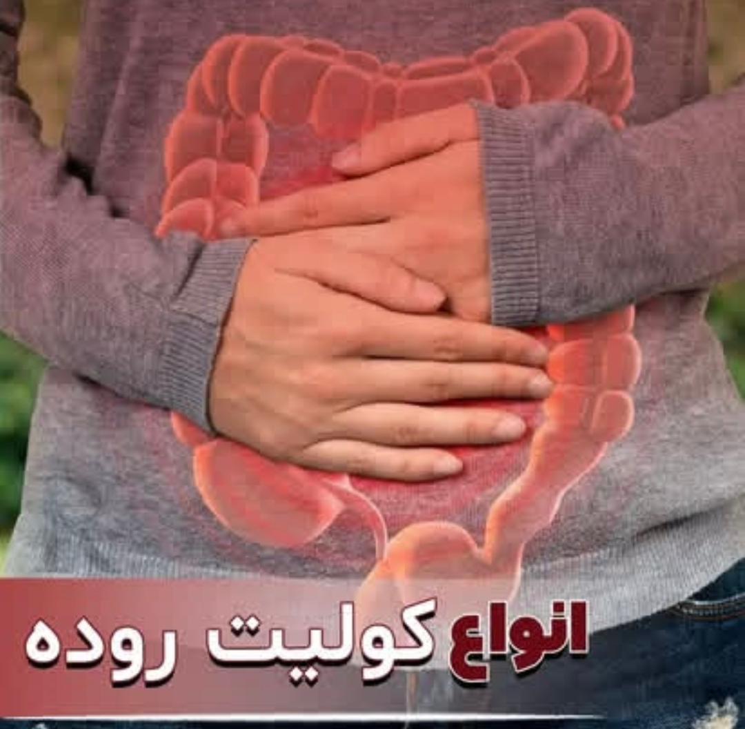 alt کولیت  روده