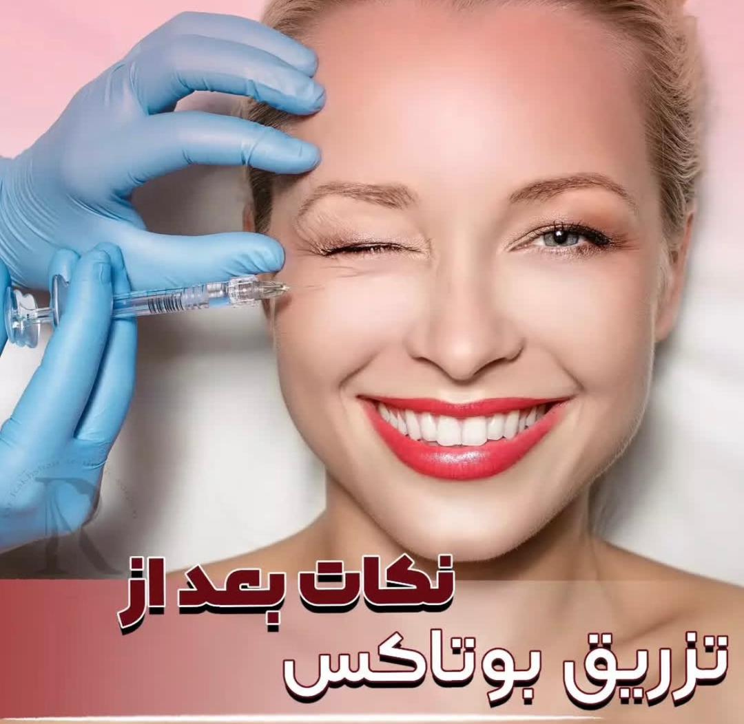 alt مراقبت های بوتاکس