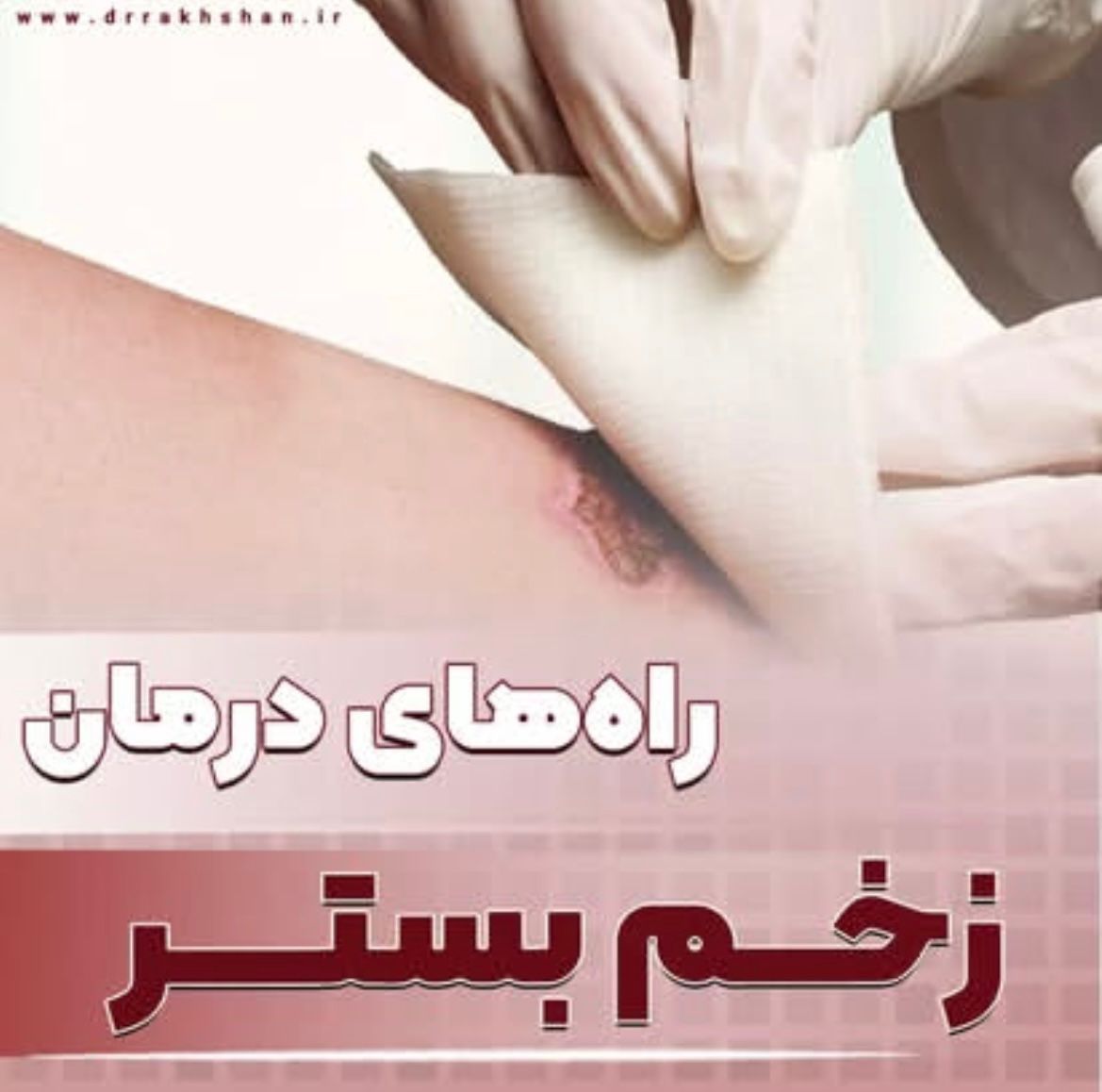 alt زخم بستر