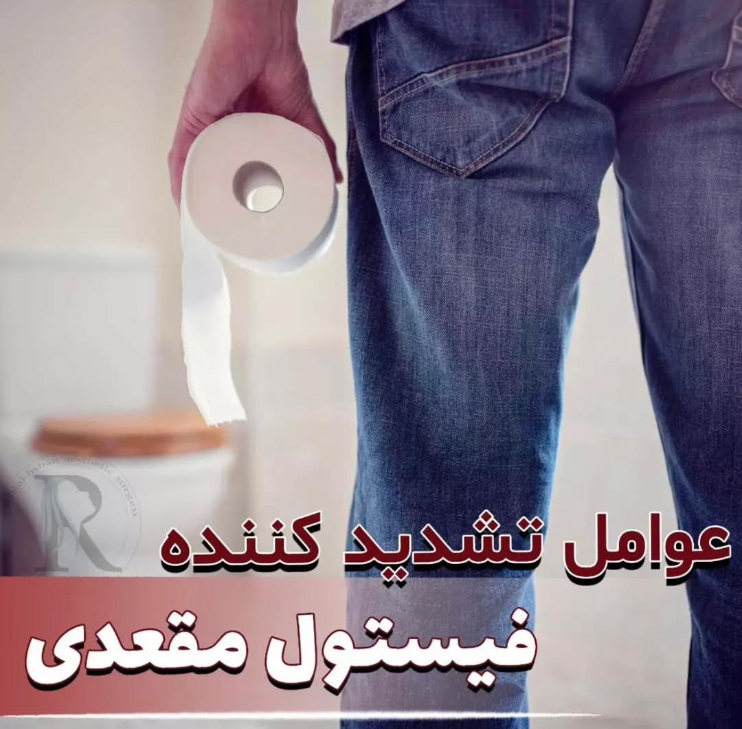 alt عوامل تشدیدکننده فیستول مقعدی