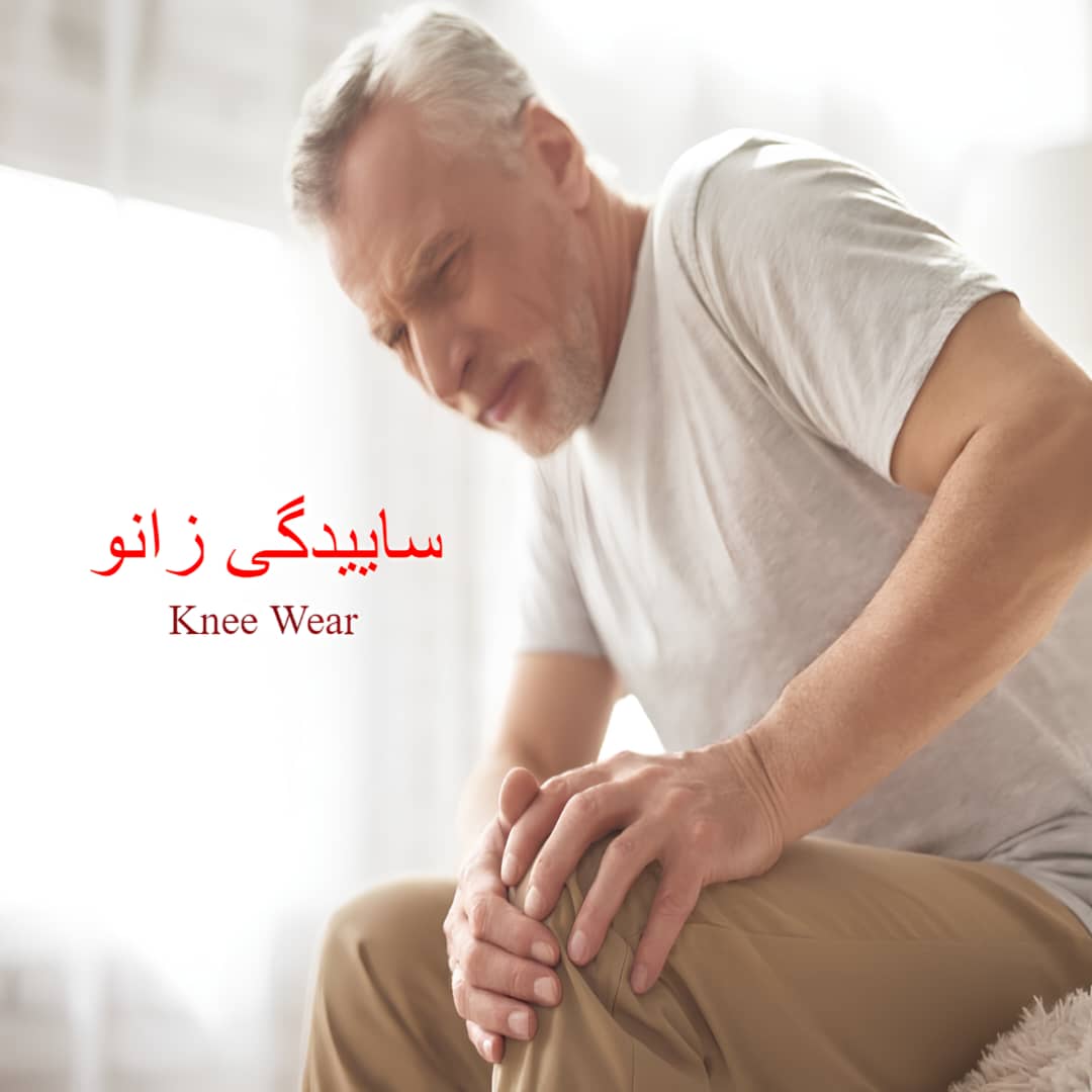 alt آرتروز زانو