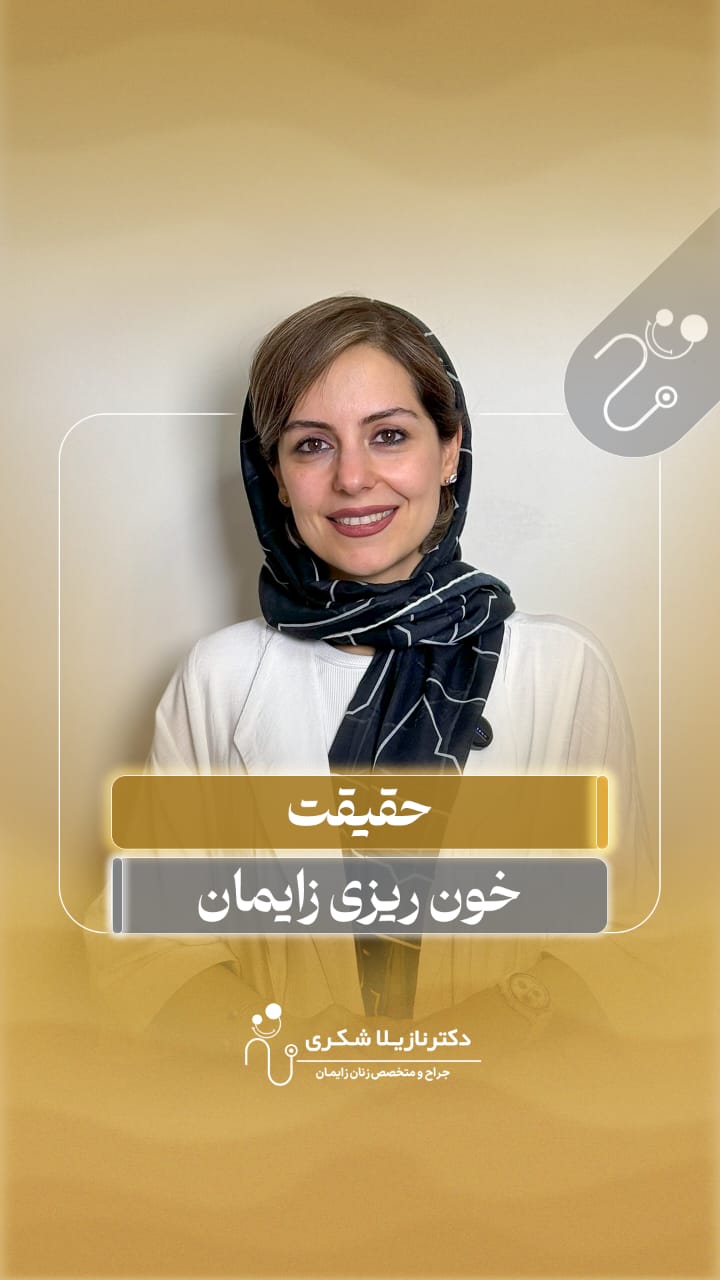 alt خونریزی زایمان